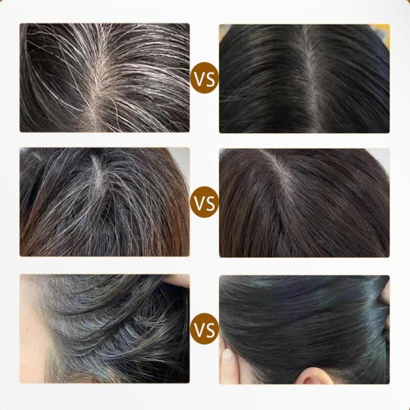 Covering White Hair is Simple and Convenient 20gm - Black 4.8 ⭐️⭐️⭐️⭐️⭐️ (1.3k) rating